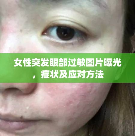 女性突發(fā)眼部過敏圖片曝光，癥狀及應(yīng)對方法