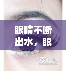 眼睛不斷出水，眼睛一直出水的是什么情況 