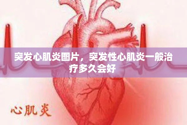 突發(fā)心肌炎圖片，突發(fā)性心肌炎一般治療多久會(huì)好 