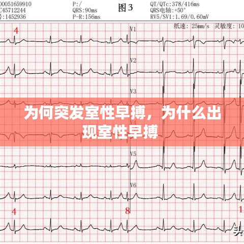 為何突發(fā)室性早搏，為什么出現(xiàn)室性早搏 