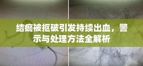 結(jié)痂被摳破引發(fā)持續(xù)出血，警示與處理方法全解析